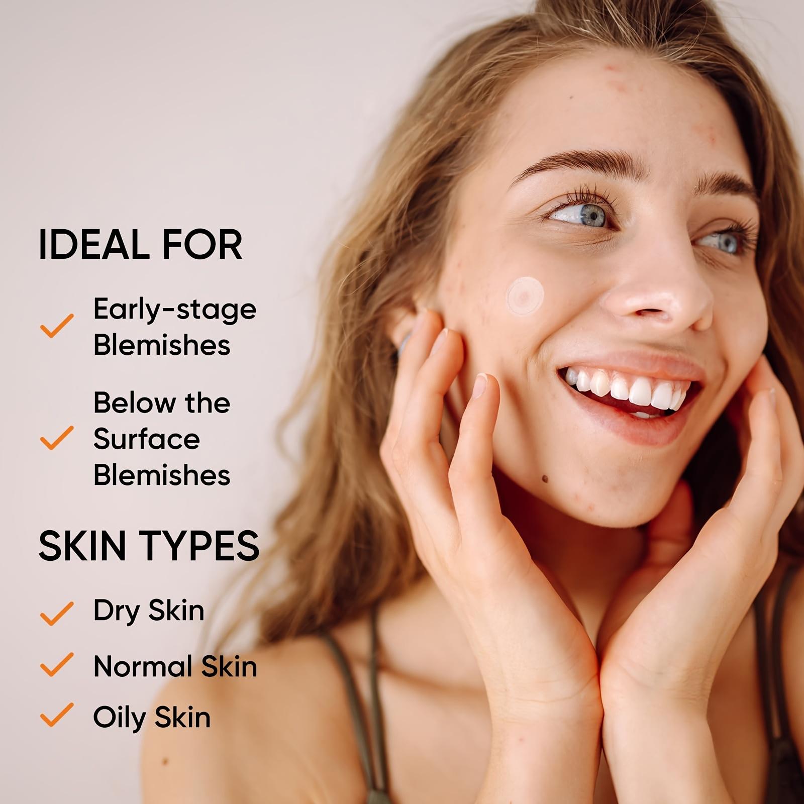 Large Hydrogel Acne Patches Xl - огляд і ціна Xl Skincare