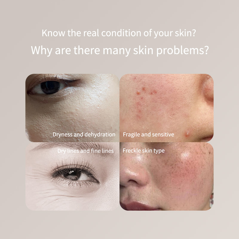Portable Skin Tester Pen - For - огляд і ціна Skincare Only You