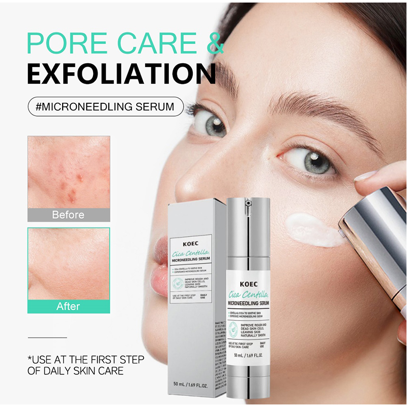 Soothing Microneedle Serum, Ce - огляд і ціна Centella Asiatica Toner