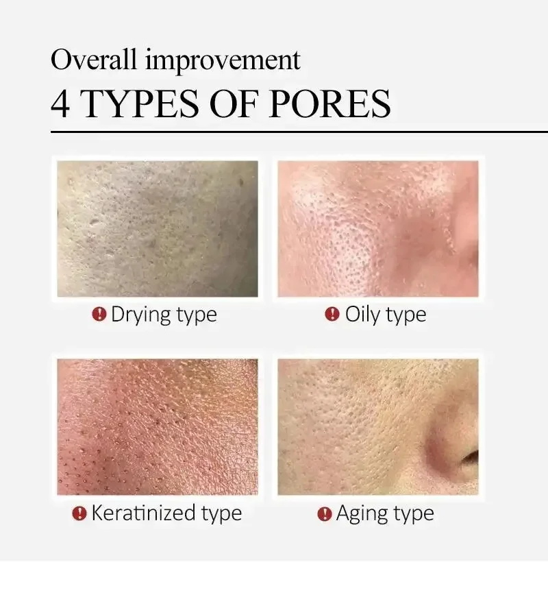 Centella Asiatica Shrink Pores - огляд і ціна Centella Asiatica Toner
